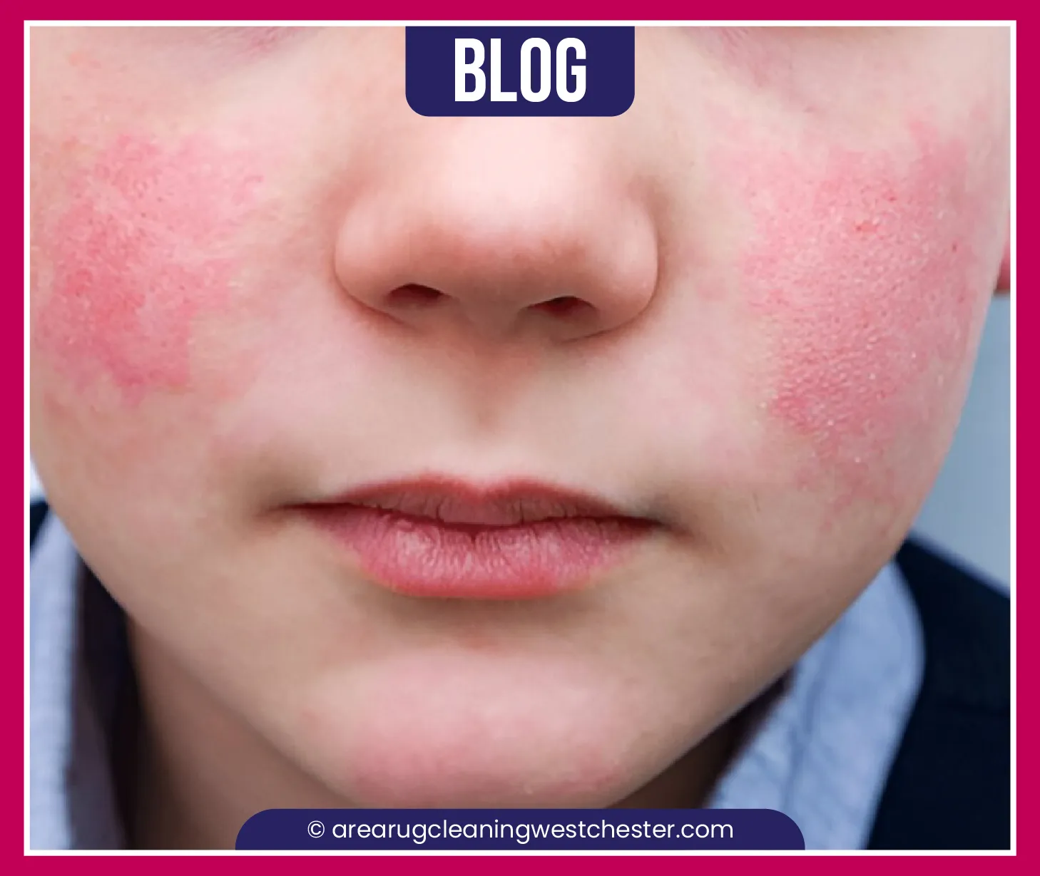 carpet cleaning in Westchester, carpet cleaning in Westchester, carpet cleaning Westchester, carpet cleaners in Westchester, carpet cleaners in Westchester, commercial carpet cleaning, commercial carpet cleaning in Westchester, Westchester rug cleaners, rug cleaning services in Westchester same day carpet cleaning, same day rug cleaning